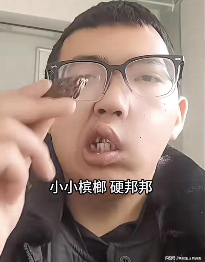 部变形还边嚼边劝大家别碰槟榔米乐m6男子嚼槟榔七年导致脸(图2)