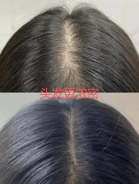 宝藏款榜首获央视认可维生素B哪个好？十大(图6)